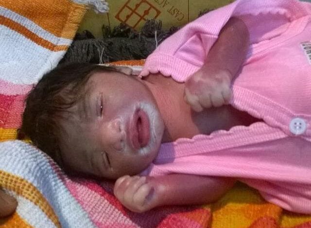 महिला ने दिया प्लास्टिक शीशु को जन्म 1 दुनिया रंग बिरंगी Woman gives birth to a plastic baby.