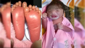 महिला ने दिया प्लास्टिक शीशु को जन्म 3 दुनिया रंग बिरंगी Woman gives birth to a plastic baby.